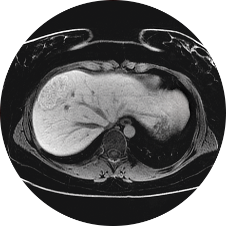 Sacramento CT Scan