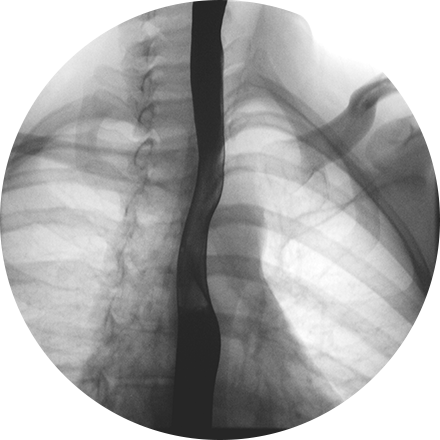 Sacramento Fluoroscopy 